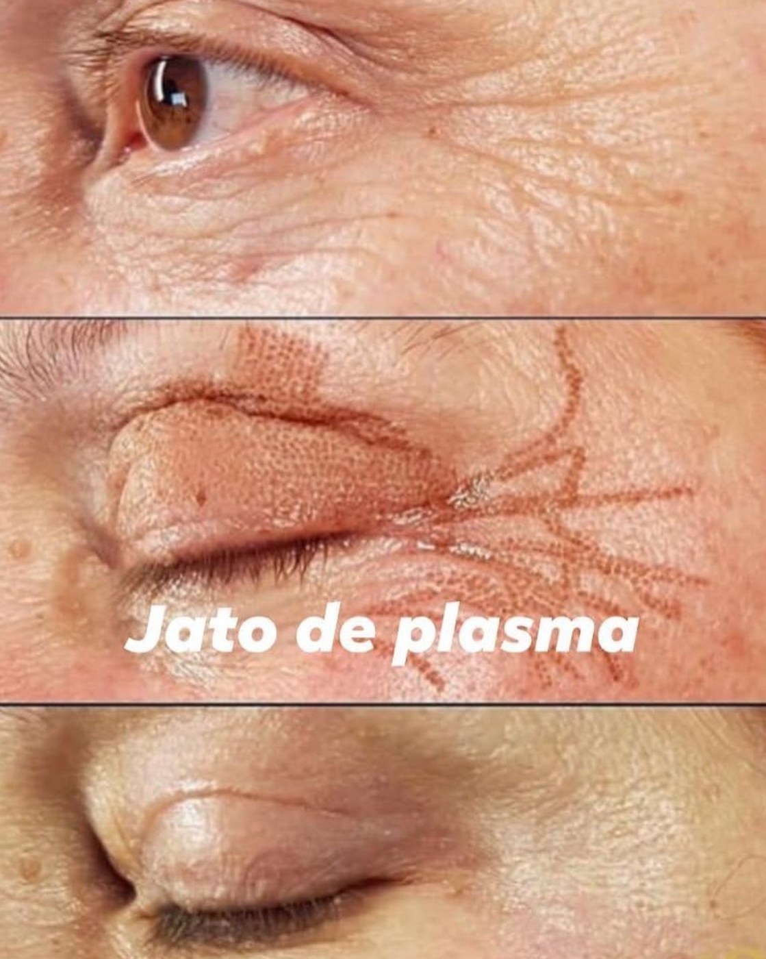 Jato de plasma